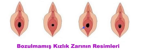 bozulmamış kızlık zarı resimleri